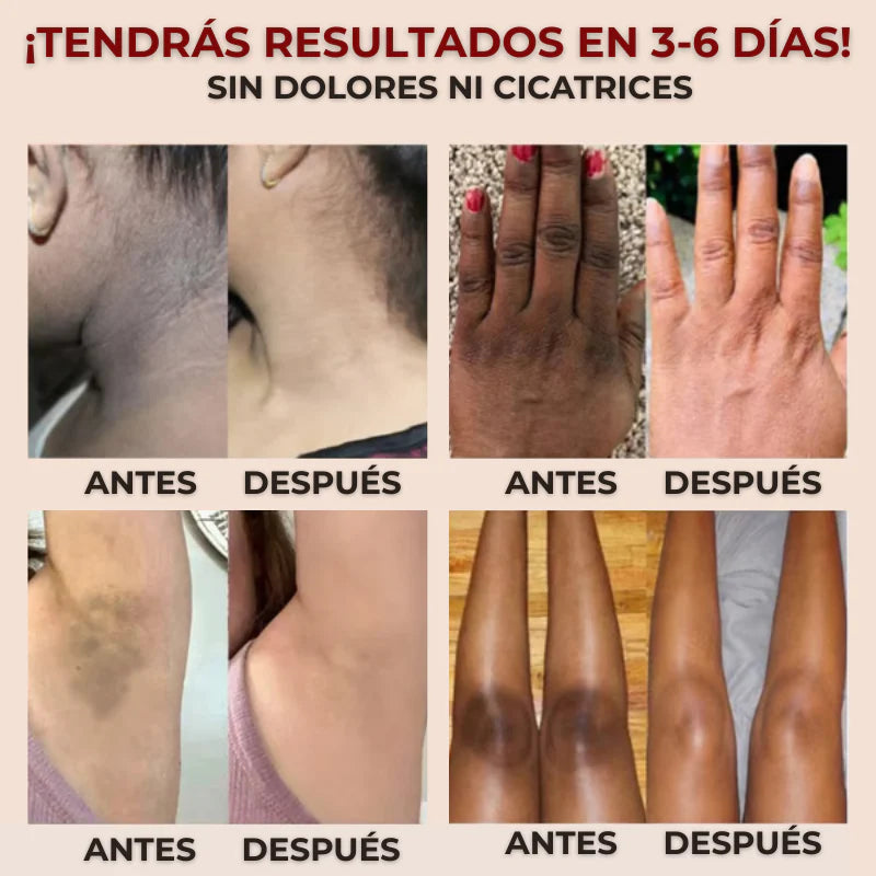 Exfoliante Quarxery Viral de Tik Tok